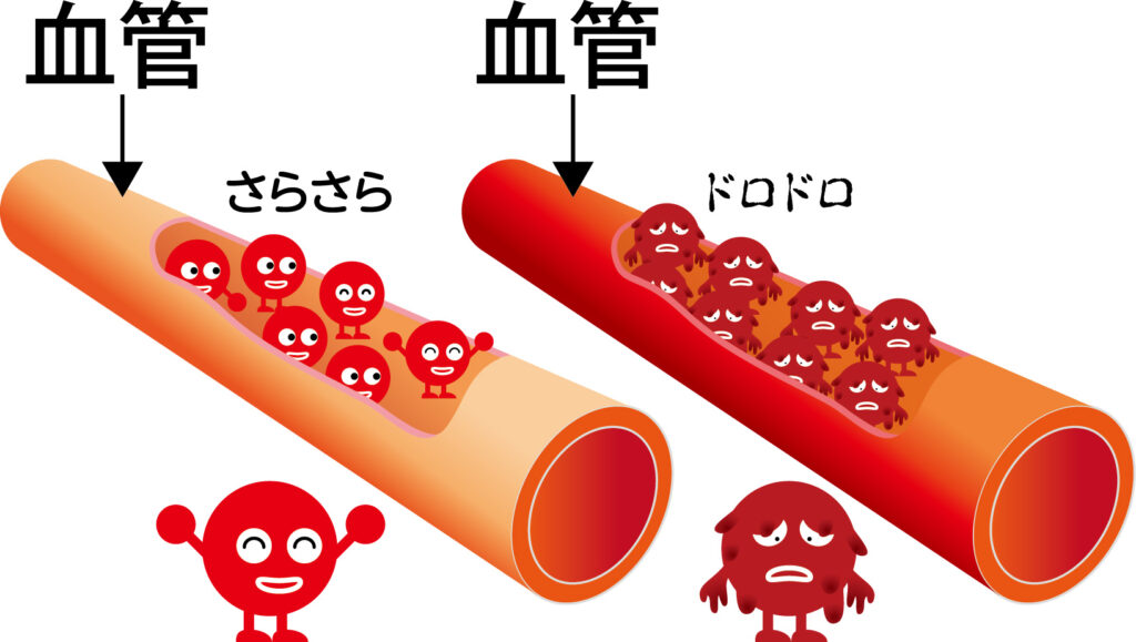 血液サラサラとドロドロの状態を比較する血管イラスト｜ほどよい堂