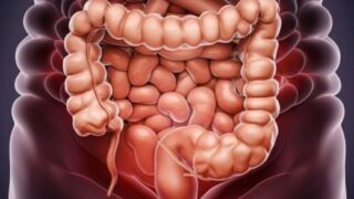 腸内フローラを改善するには何を摂るべき？必須栄養素と効果的サプリまとめ