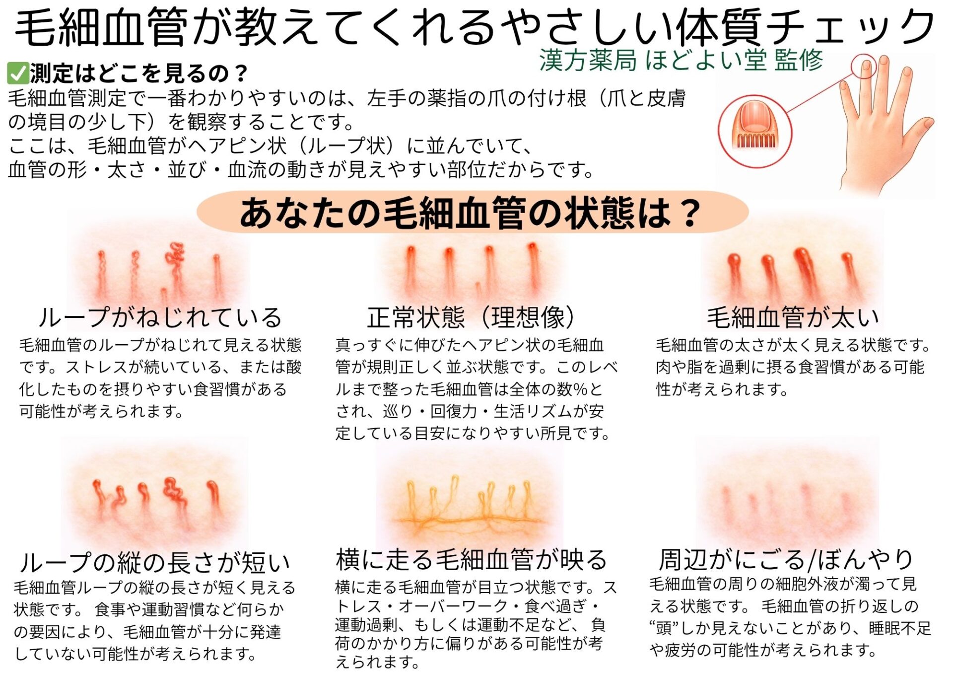 毛細血管測定のイメージ写真