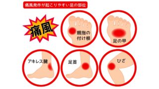 尿酸は悪者だけじゃない？抗酸化作用と炎症リスクの二面性をわかりやすく解説