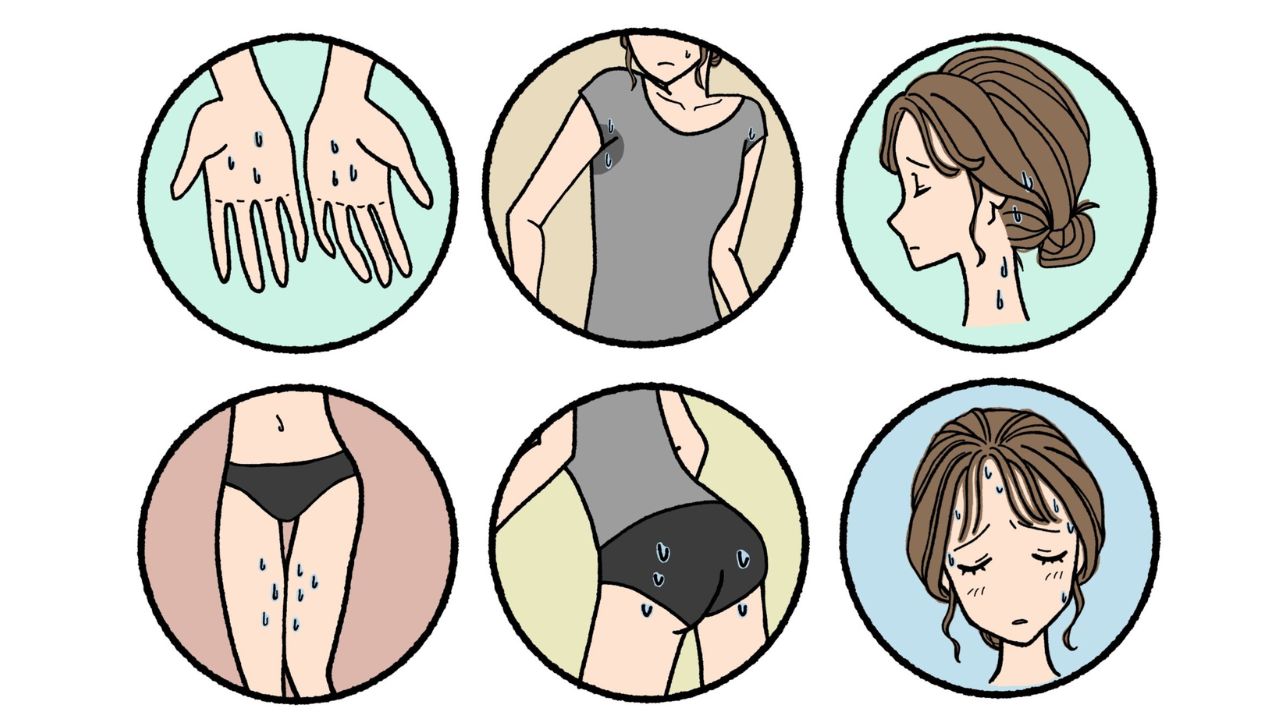 多汗症のイメージ画像