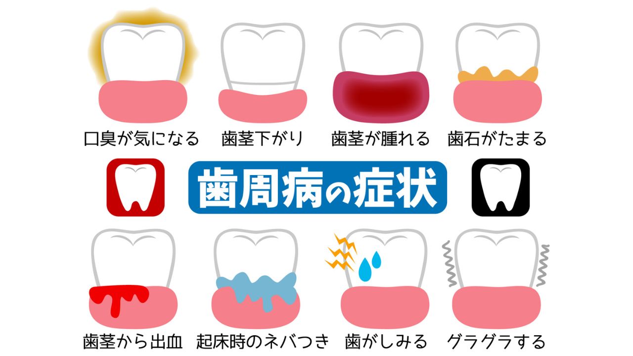 歯周病と口臭の関係をイメージした写真
